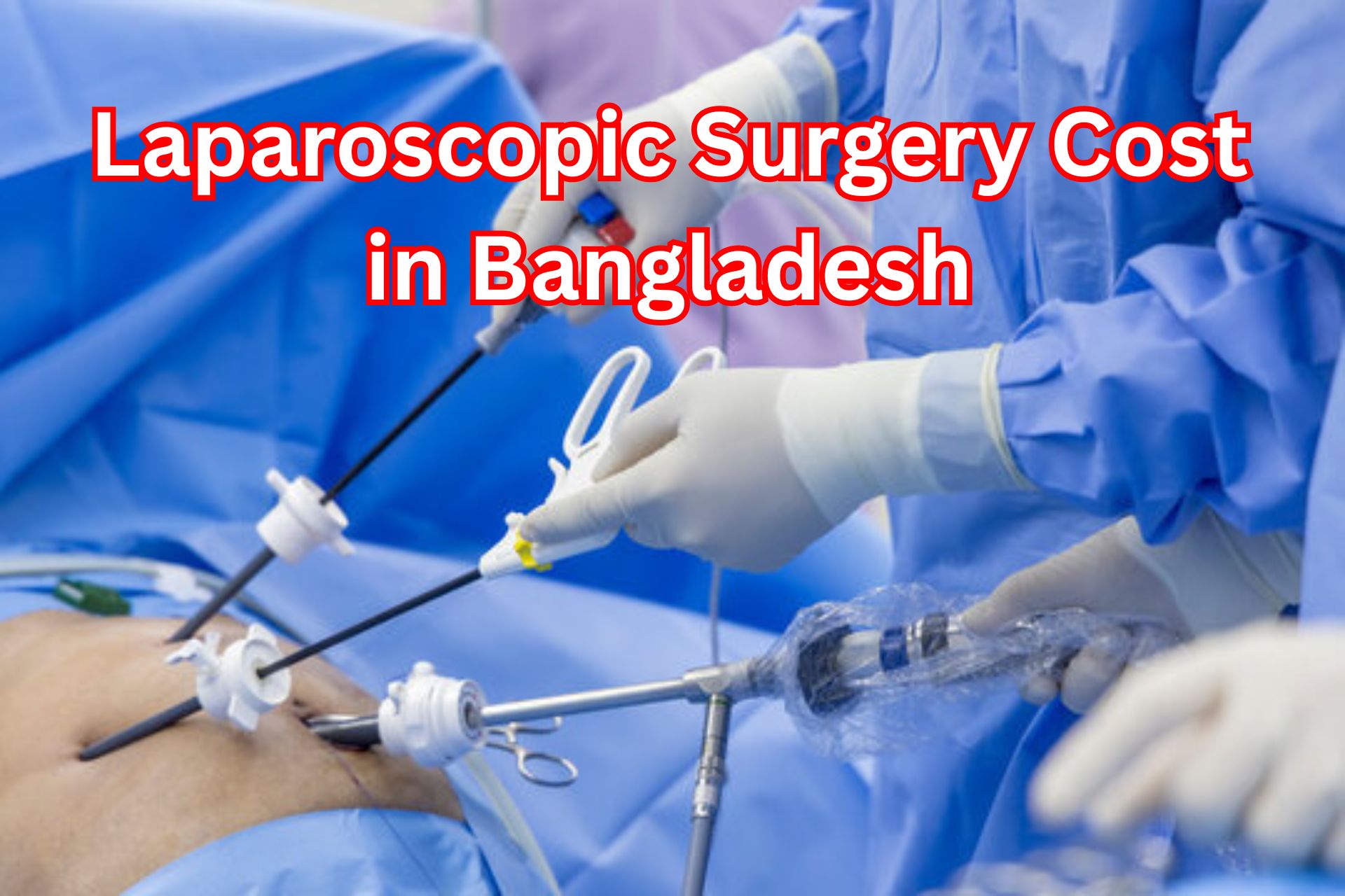 Laparoscopic Surgery Cost in Bangladesh.